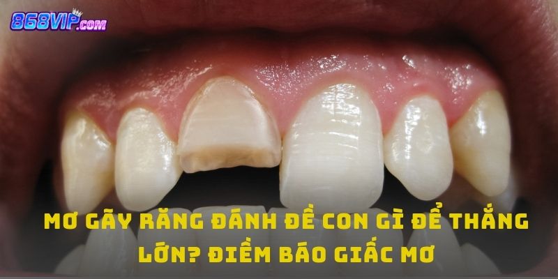 Giải mã mơ gãy răng đánh đề con gì theo từng tình huống